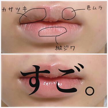 唇のくすみを徹底対策 ぷるぷるリップを手に入れる3つの神器 Lips