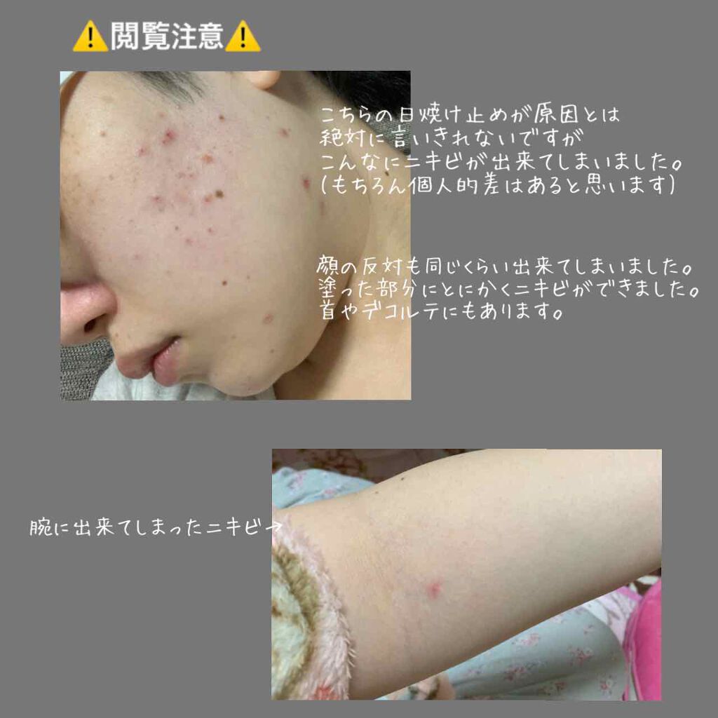 ビオレuv キッズピュアミルク ビオレの辛口レビュー ごめんなさ By ばにらうさぎ ʚ ɞ 混合肌 代後半 Lips