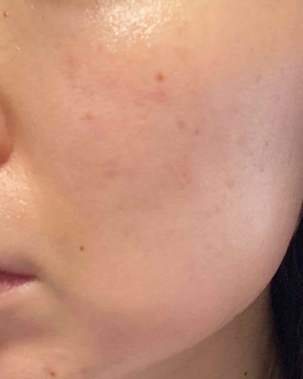 ダブル セーラム Ex Clarinsの口コミ 毛穴の開きは気になるけど ニキビはすごく治 By のん 乾燥肌 Lips