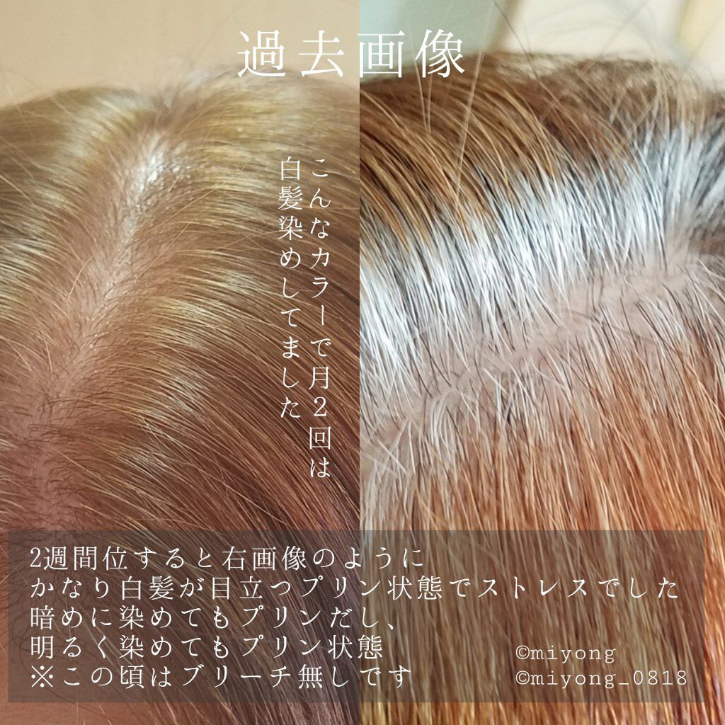 F プロテクト ヘアシャンプー ベーシック Fiole フィヨーレ を使った口コミ 脱白髪染め 白髪ぼかしハイライト3 アデ By Miyo 混合肌 40代前半 Lips