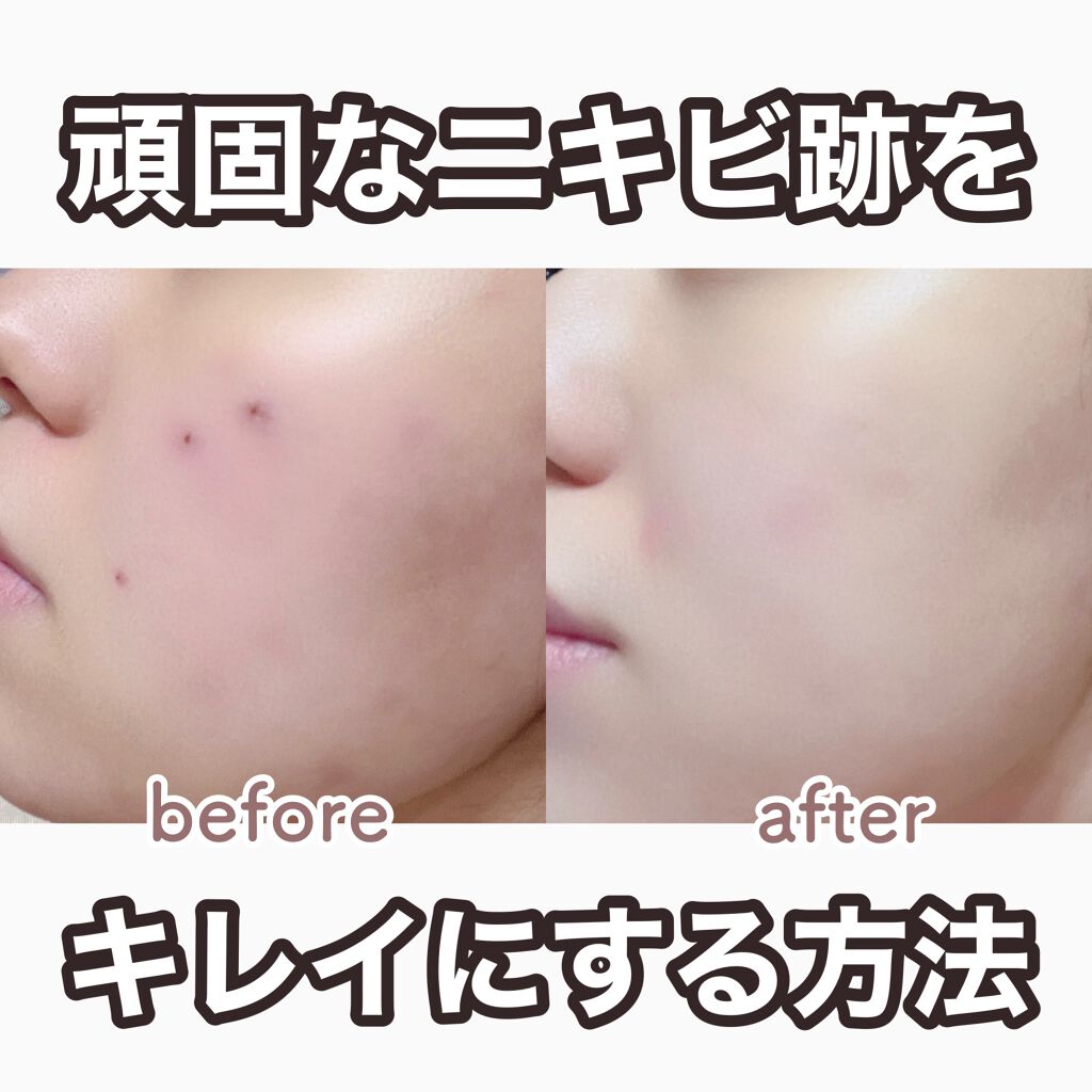 白色ワセリン 医薬品 日本薬局方の画像 動画一覧 Lips