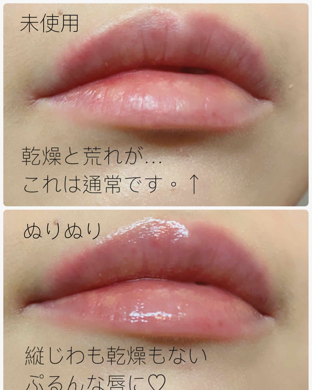 38 C 99 F Lip Treatment Uzu By Flowfushiの口コミ 3枚目 唇アップあります 私が絶対手 By Minmin 敏感肌 30代後半 Lips