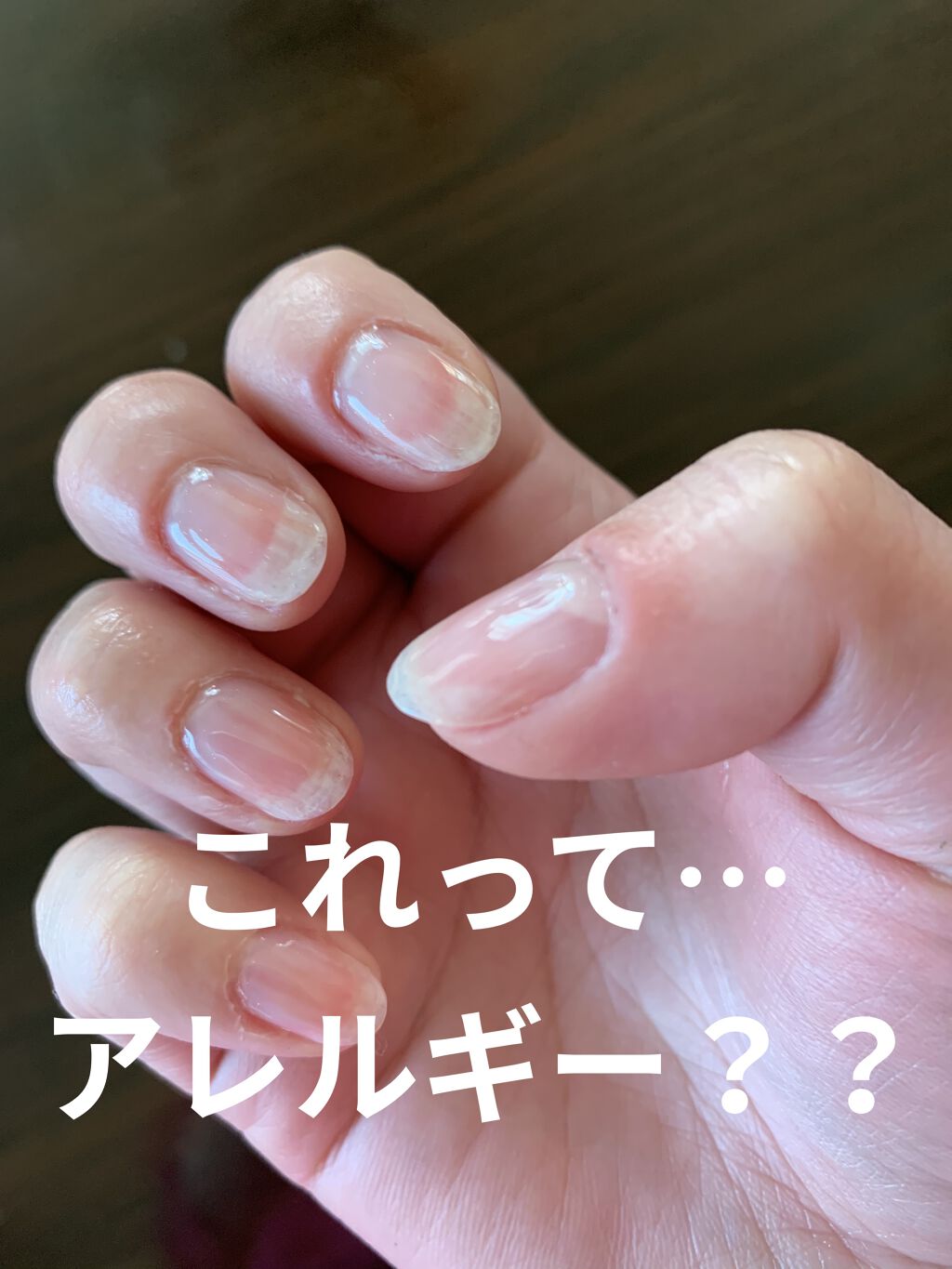 キャンジェルノンワイプクリア プリジェルを使った口コミ ジェルアレルギーとは ただいま母親が入院 By 白 フォロバします 脂性肌 40代前半 Lips