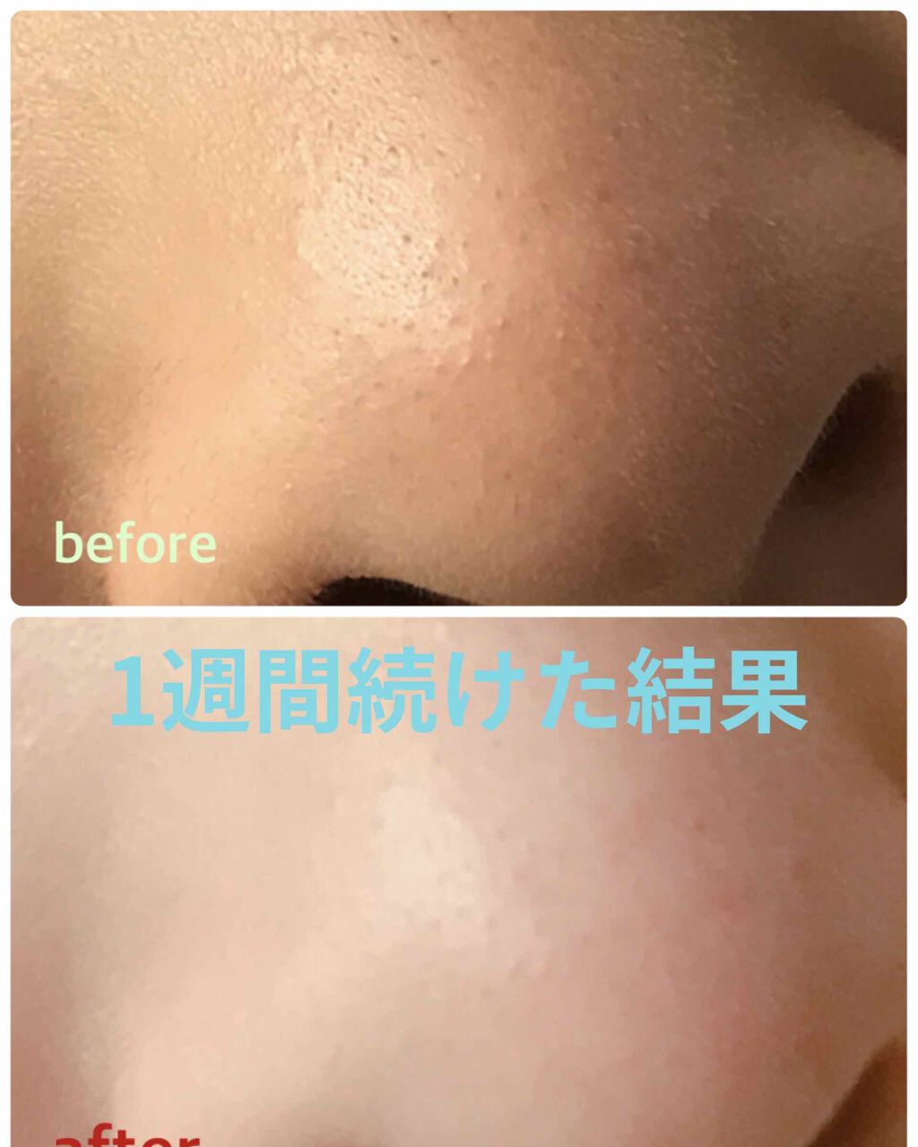 ホホバオイル 無印良品の口コミ 今回はホホバオイルを1週間試した結果をお知 By あ 混合肌 Lips