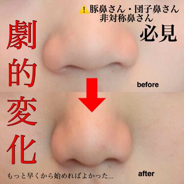 Refa S Carat Refaを使った口コミ こんにちは 今回は私が1番コンプレックスに By Cher 10代後半 Lips