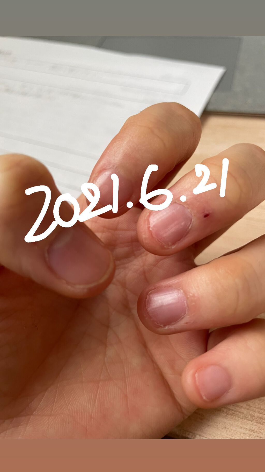 クイックケアコート Ettusaisの口コミ やっぱり何かあると爪をむしってしまう どう By るぅ Lips