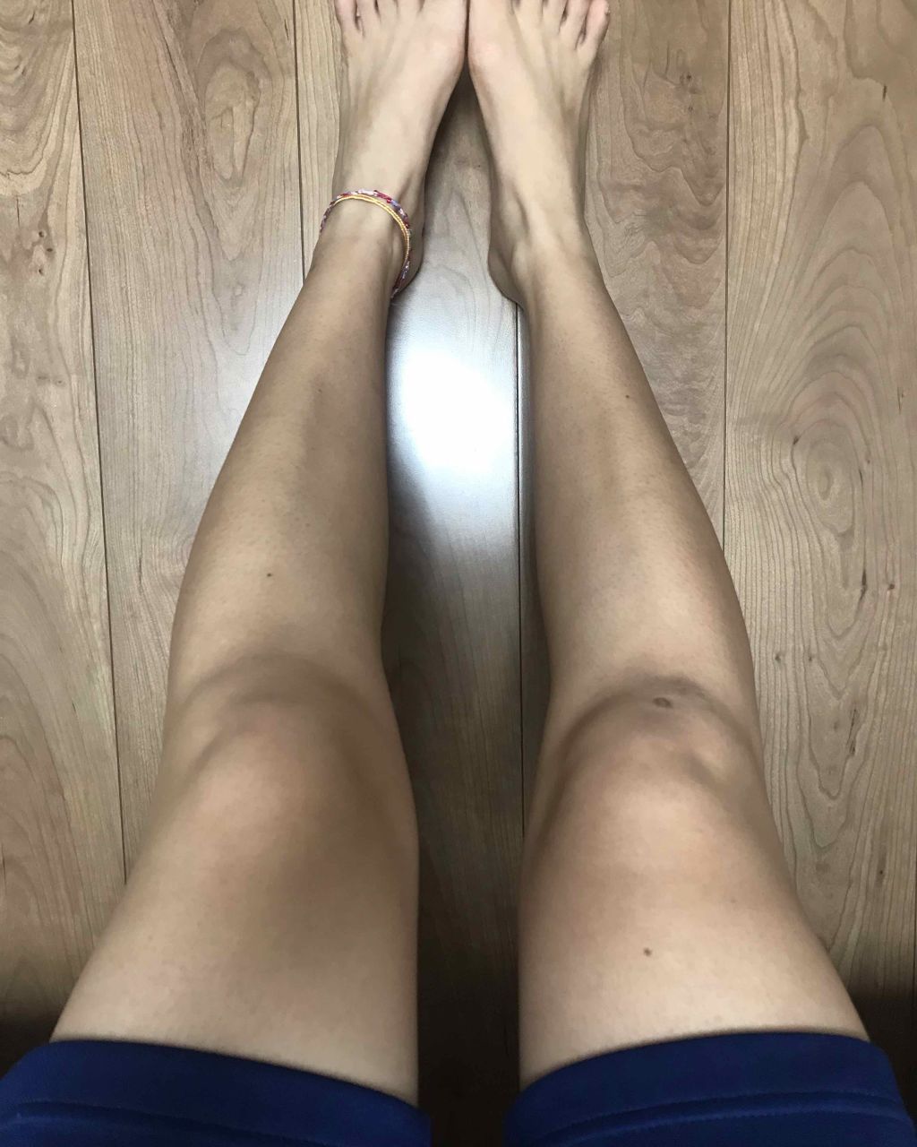 ナチュリエ ハトムギ化粧水 ナチュリエ スキンコンディショナー H ナチュリエを使った口コミ こんにちは 2 3枚目に汚い脚の写真 By Tachikohei 脂性肌 10代後半 Lips