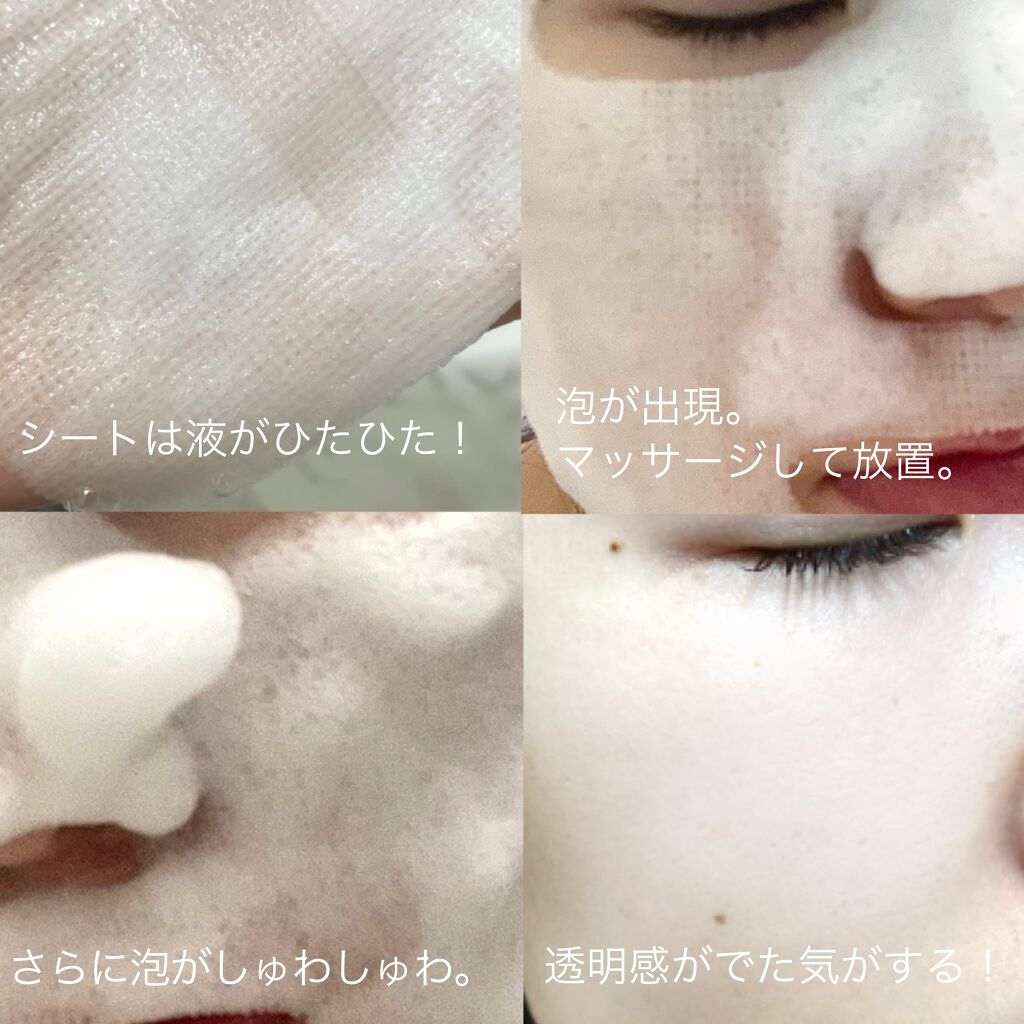 炭酸バブルパック 洗い流すタイプ イエスパを使った口コミ エステのような贅沢パック Iespa By まるこ 普通肌 Lips