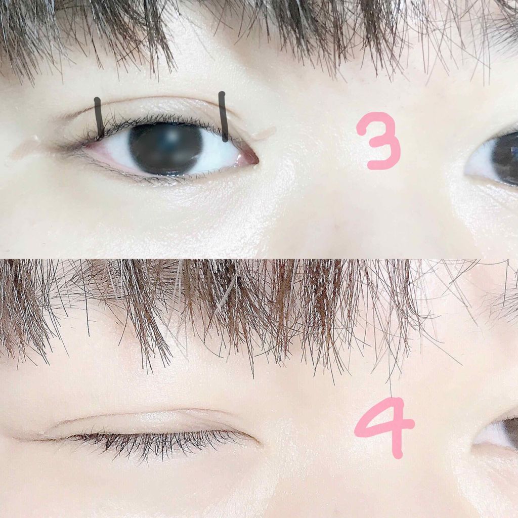 のび る アイテープ 絆創膏タイプ Daisoの口コミ 超優秀 100均で買えるおすすめ二重まぶた用アイテム 今日投稿しようと思 By ゴリゴリのイエベ 代前半 Lips