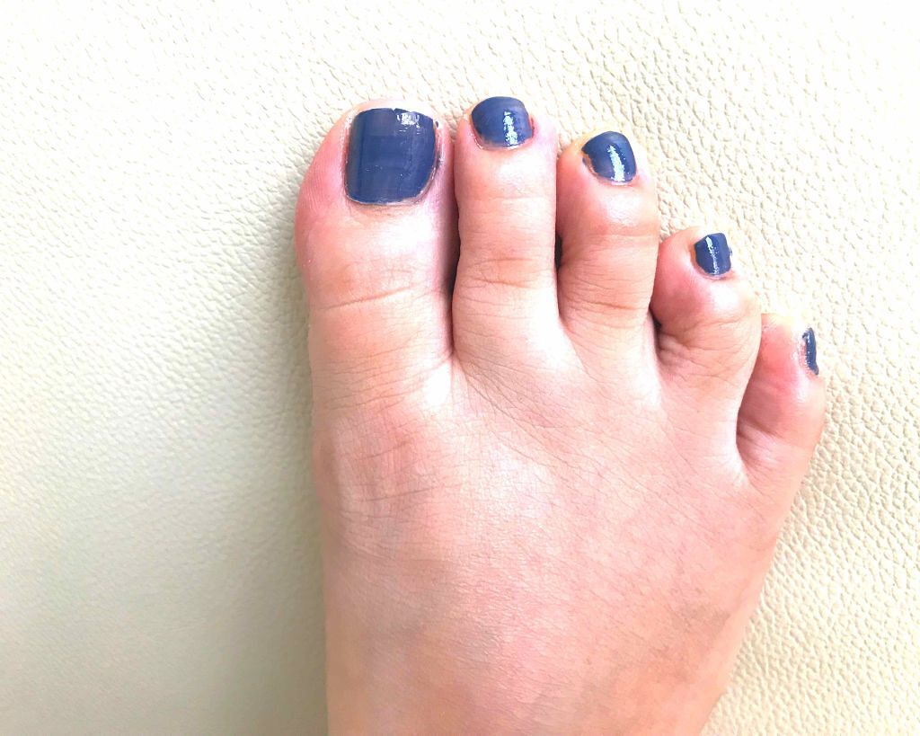 ディオール ヴェルニ Diorの口コミ 久しぶりの投稿です フットネイルの写真お By うすしお 混合肌 Lips