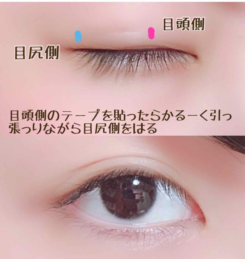 防水透明バン Daisoの口コミ 本当にバレない 100円でできる二重 って By うめこぶ茶 敏感肌 10代後半 Lips