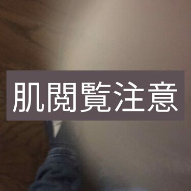 デュアック配合ゲル 医薬品 ポーラファルマの口コミ ニキビ跡に効くもの教えてください 最近の肌 By フワフワネコチャン 乾燥肌 10代後半 Lips