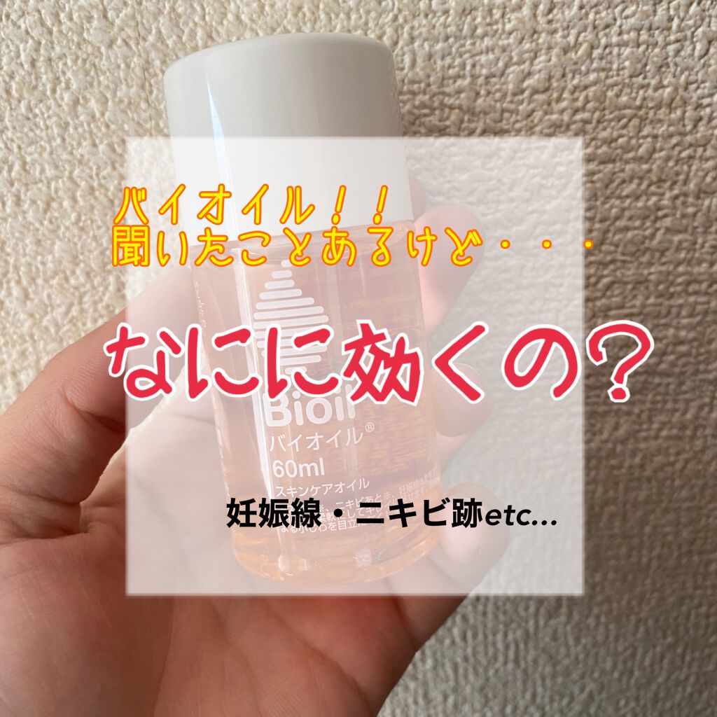 バイオイル バイオイルの使い方を徹底解説 妊娠線やら ニキビ跡やら うざったい By キイチャンマン フォロバ100 乾燥肌 Lips