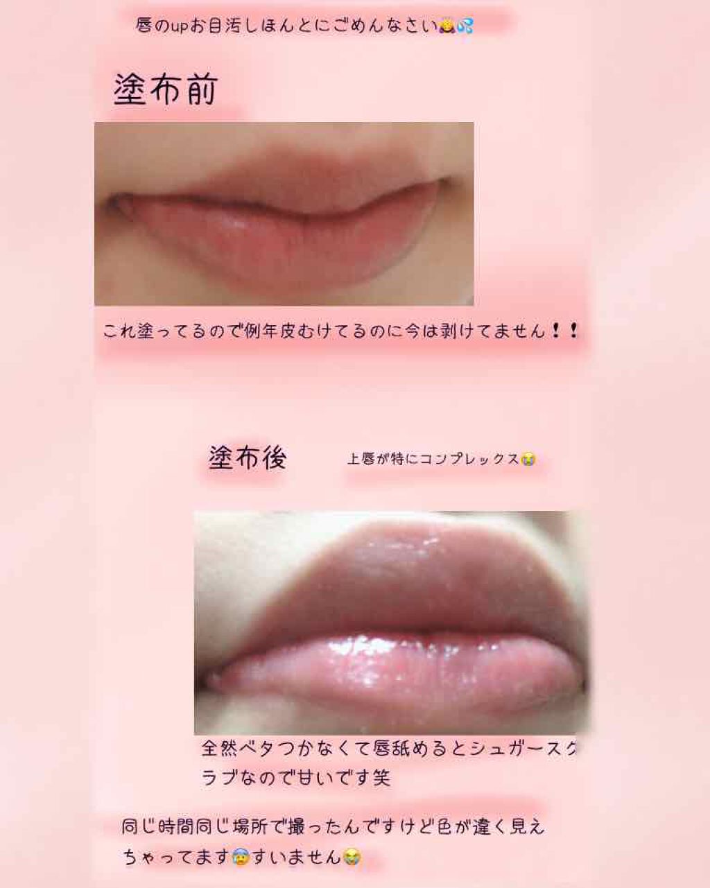 レブロン キス シュガー スクラブ Revlonの口コミ 画像に唇のupした写真がありますご注意く By まっちゃ 10代後半 Lips