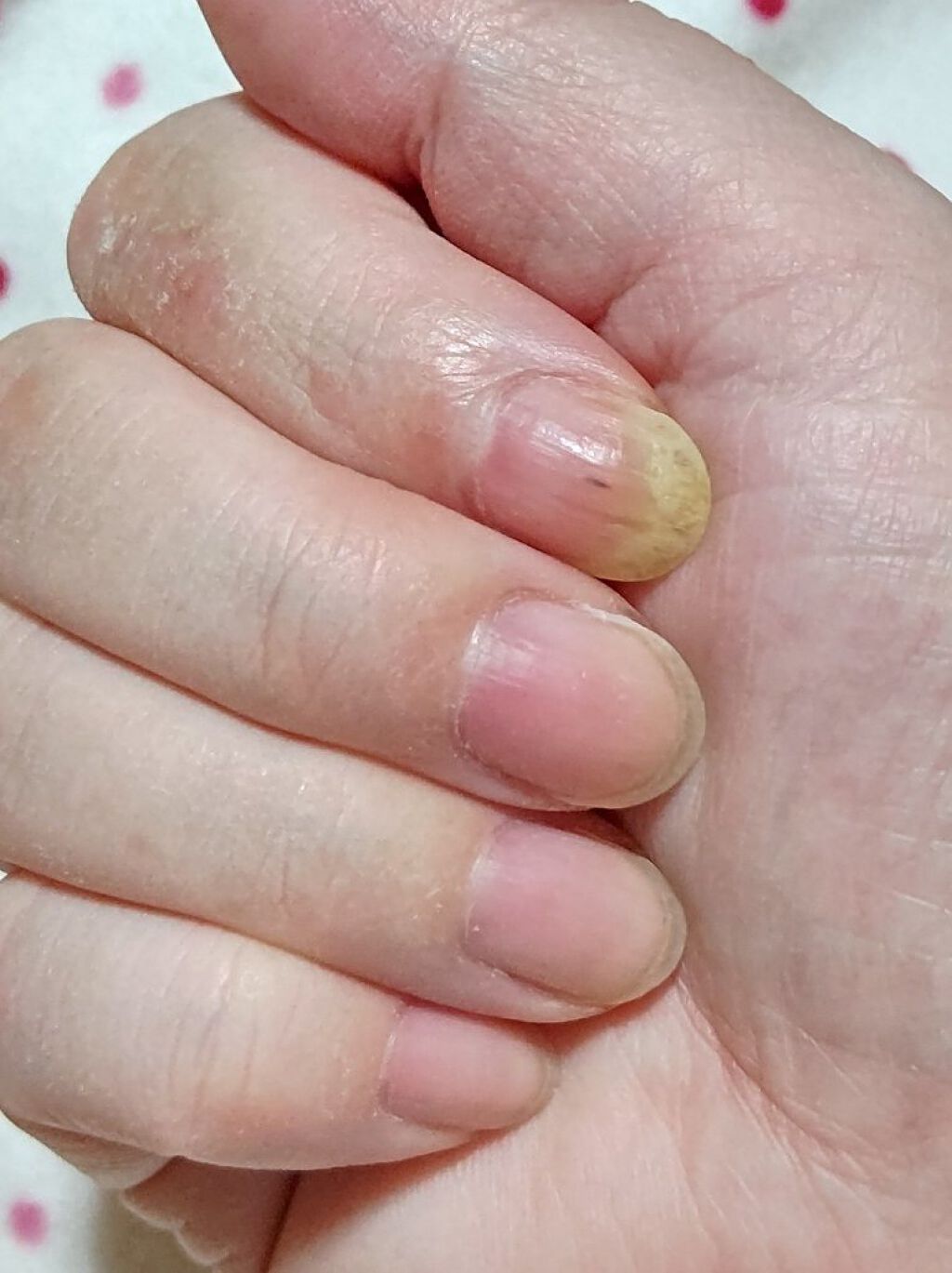 ハンドベール プレミアムリッチネイル メンソレータムの画像 動画一覧 Lips