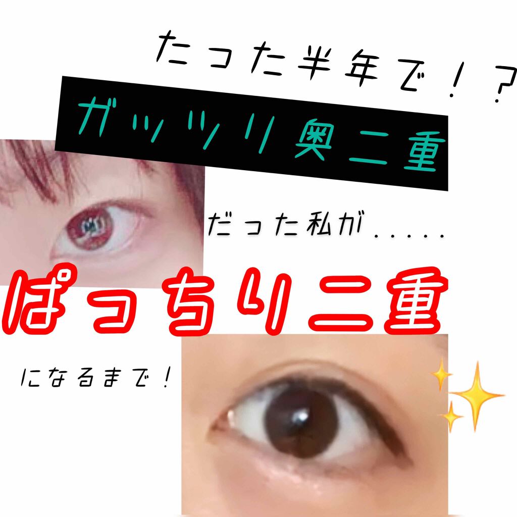 二重になる方法 プリュドール ナチュラル Style Nobleの使い方や二重メイク 私が約半年で二重になっ By 源義経 乾燥肌 10代前半 Lips