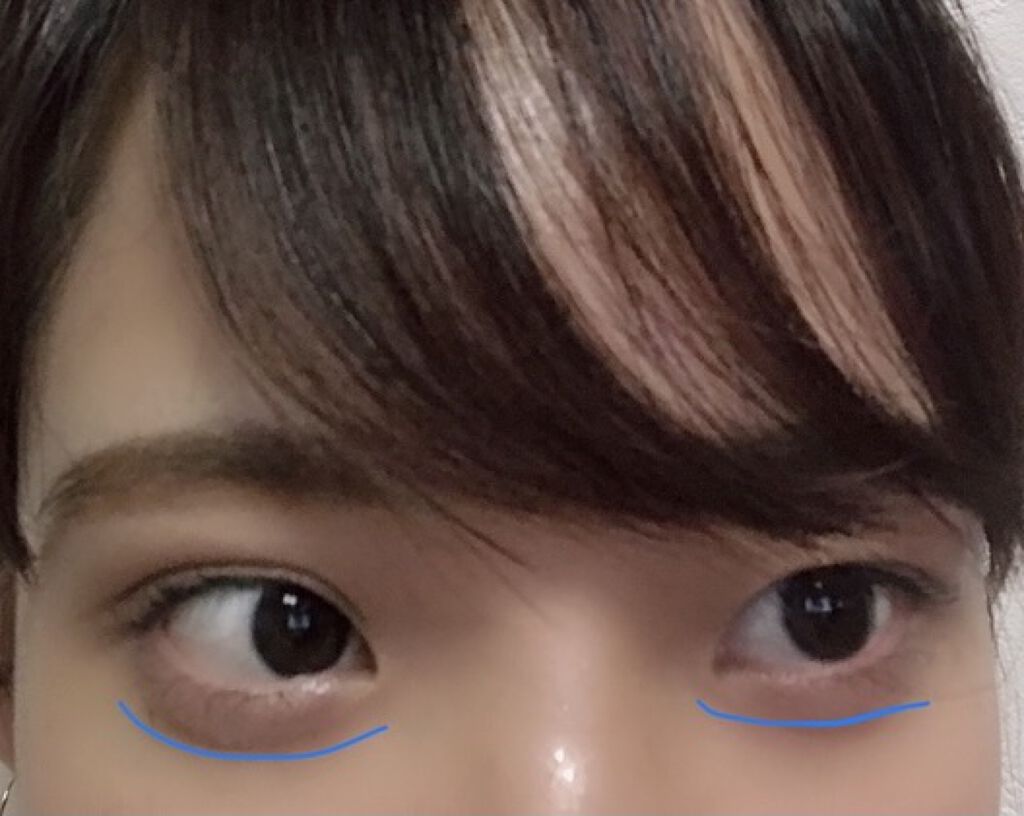 アイラッシュフィクサーex 552 D Upを使った口コミ 整形不要 自力で涙袋を作る方法 たった By とがちゃん 乾燥肌 代前半 Lips