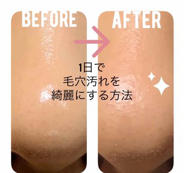 スムージングジェルウォッシュ Lunasolの口コミ 毛穴汚れを1日で綺麗にする方法毛穴の黒ずみ By くりまるも 代後半 Lips