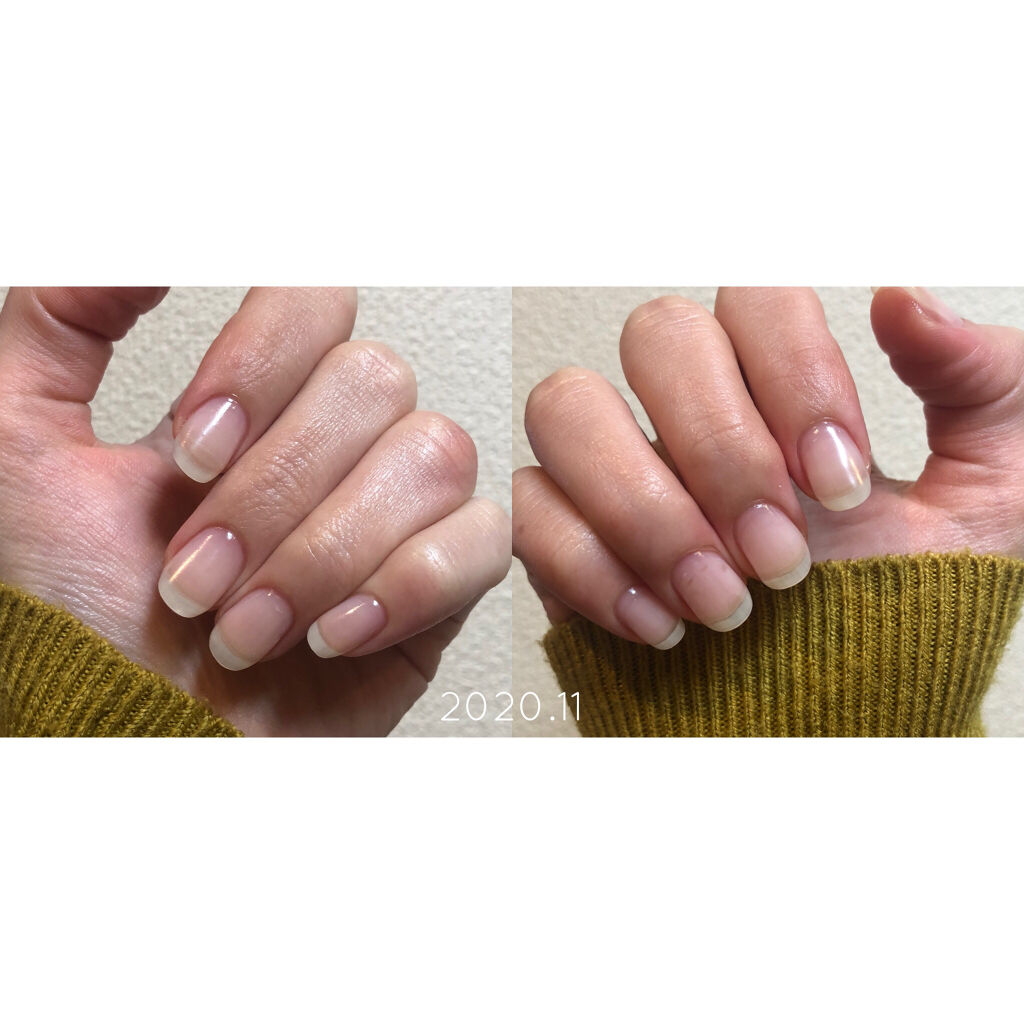 スウィートアーモンドオイル 無印良品を使った口コミ 育爪経過報告 素爪の頃からの変化が目に見 By てらお 敏感肌 代後半 Lips