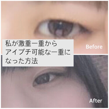 オロナインｈ軟膏 医薬品 オロナインの口コミ 激重一重からアイプチ可能な瞼になった方法 By ぱせり 混合肌 代前半 Lips