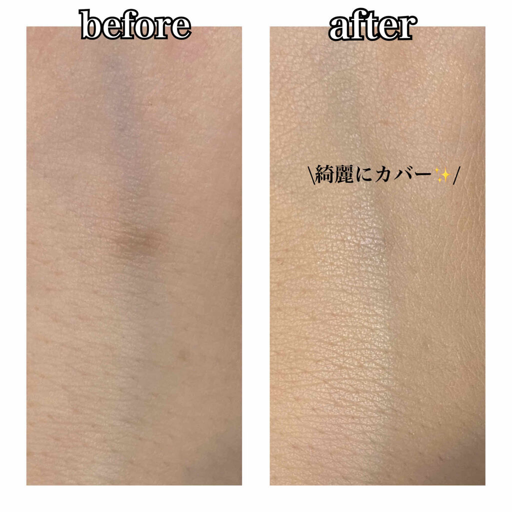 Sp クッション ウルトラカバークッション Maybelline New Yorkの口コミ 混合肌におすすめのクッションファンデーション ニキビ跡もなかったこと By もか 乾燥肌 代前半 Lips