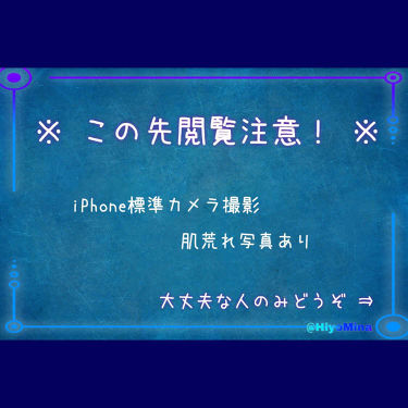 White Whipping Cream ウユクリーム G9 Skinの辛口レビュー G9wクリーム 噂のウユクリーム 肌荒れ By ひよみな 乾燥肌 Lips