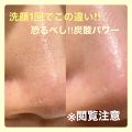 yocchinのクチコミ「【SODA SPA FOAM PR...」