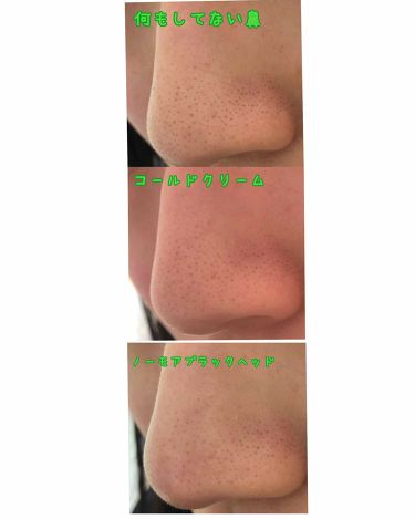 スキンケア方法 ウォッシャブル コールド クリーム ちふれの使い方 効果 グロ注意 鼻の黒ずみ By うさうさ 脂性肌 10代後半 Lips