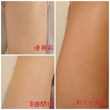 二の腕ザラザラを洗う重曹石けん ペリカン石鹸の口コミ 約1ヶ月試させて頂きました 正直 2 3日 By こころん 乾燥肌 30代後半 Lips