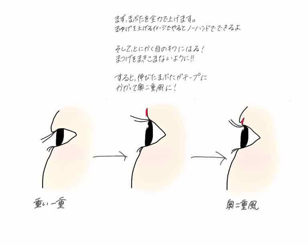 のび る アイテープ 絆創膏タイプ Daisoの口コミ 超優秀 100均で買えるおすすめ二重まぶた用アイテム 超絶重たい一重の方 By リン子 Lips