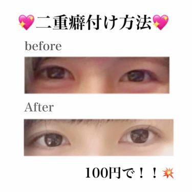 防水透明バン Daisoの口コミ 超優秀 100均で買えるおすすめコスメ こんにちは 私が1年間 By メ 普通肌 代前半 Lips