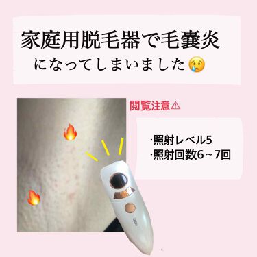 オロナインｈ軟膏 医薬品 オロナインを使った口コミ こんにちは セルフ脱毛など脱毛に関する投 By Sari 混合肌 代前半 Lips