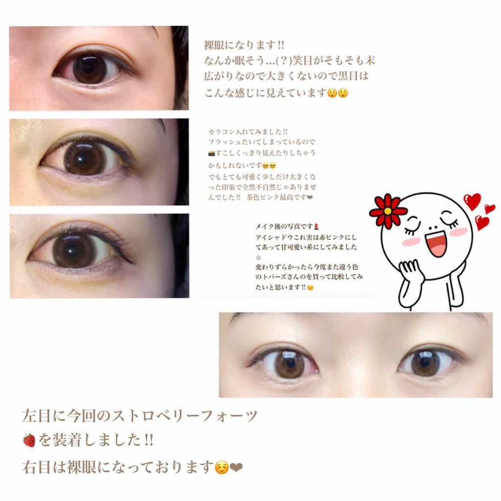 Topards Topardsのカラコンレポ 着画口コミ またまたこんにちは みょんです 今回は指 By みょん フォロバします 脂性肌 20代前半 Lips