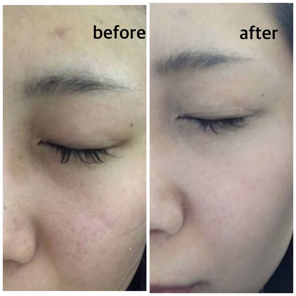 クラブ すっぴんパウダー クラブの口コミ 本日は私のお泊りでの必需品を紹介します By Aya 普通肌 代後半 Lips