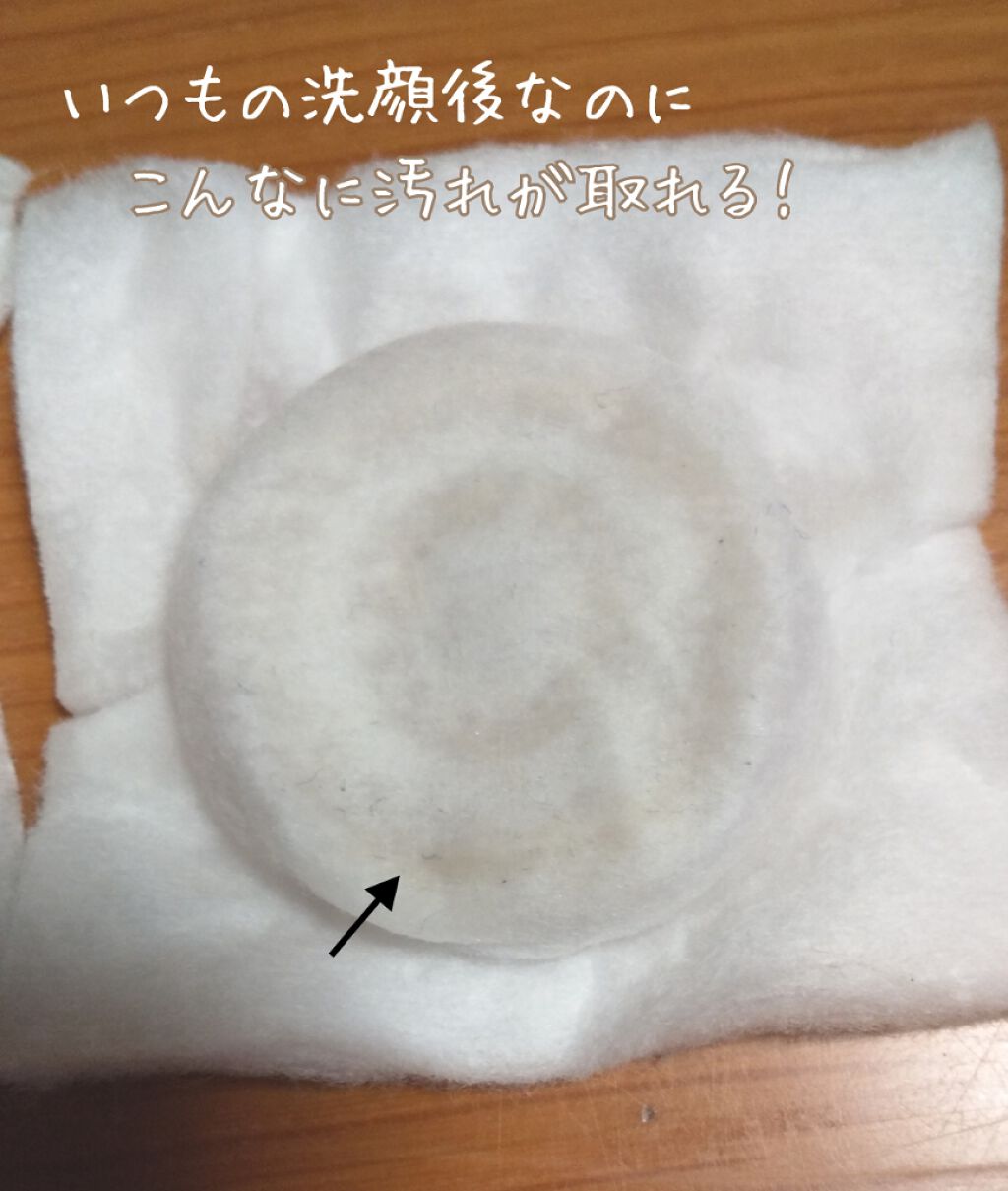 Rfボーテ フェイスex ヤーマンの口コミ 今回は人気家庭用美容器について詳しくレビュ By いももち 毛穴 混合肌 代前半 Lips