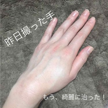 ナノアミノ ハンド ネイルリペアクリーム ナノアミノの口コミ アイシャドウバケモノと言われたズボラです By ズボラ母 乾燥肌 Lips