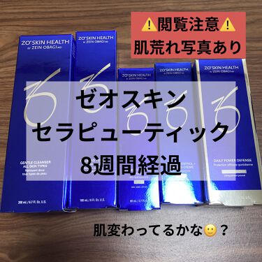 ミラミックス Zo Skin Healthを使った口コミ ゼオスキン日記 8週間経過ゼオスキン日記 By ワタクシ ブルベ冬 敏感肌 30代前半 Lips