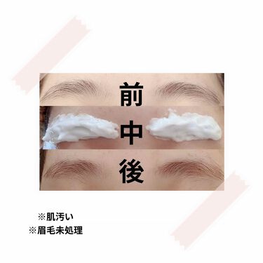 脱色クリームスピーディー エピラットの口コミ コロナで家から出ない 人に会わない 眉 By れおん 混合肌 代前半 Lips