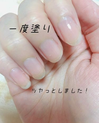 ネイルサポート ピンク ネイルネイルの口コミ 肌と同じくらい悩みが多い私の爪薄い 弱い By 葵 乾燥肌 代後半 Lips