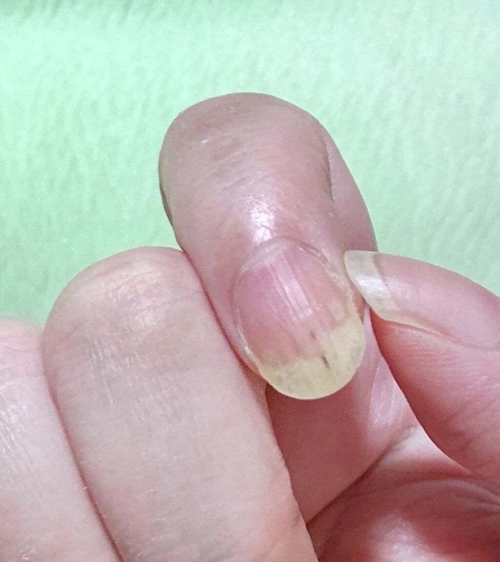 ハンドベール プレミアムリッチネイル メンソレータムの画像 動画一覧 3ページ目 Lips