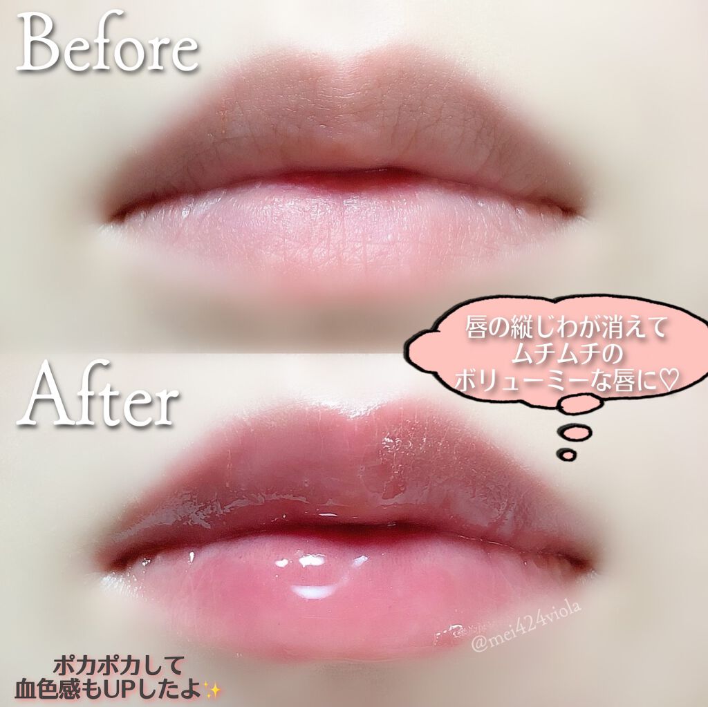 Hotomi リッププランパー Hotomiの口コミ 韓国コスメ ୨୧ By めいﾁｬﾝ 混合肌 30代前半 Lips