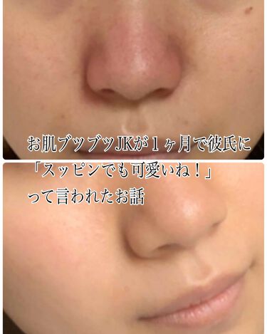 年代 肌質別 薬用しみ対策 美白化粧水 メンソレータム メラノccの口コミ 1321件 Lips