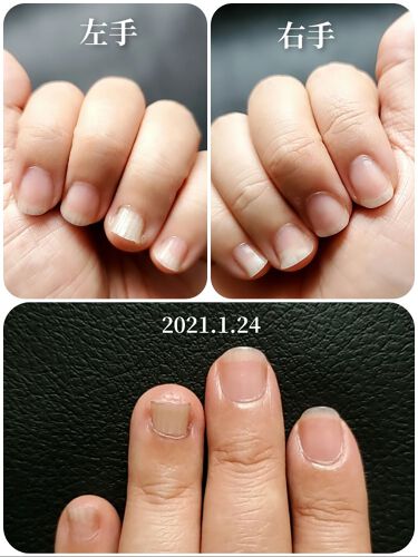 クイックケアコート Ettusaisを使った口コミ 爪甲剥離症の育爪記録以前の投稿はこちらに By かぴめろん 乾燥肌 40代後半 Lips