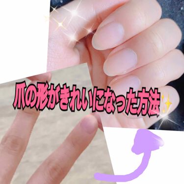 クイックケアコート Ettusaisの口コミ 爪の形がきれいになった方法 長々書いても By 混合肌 Lips