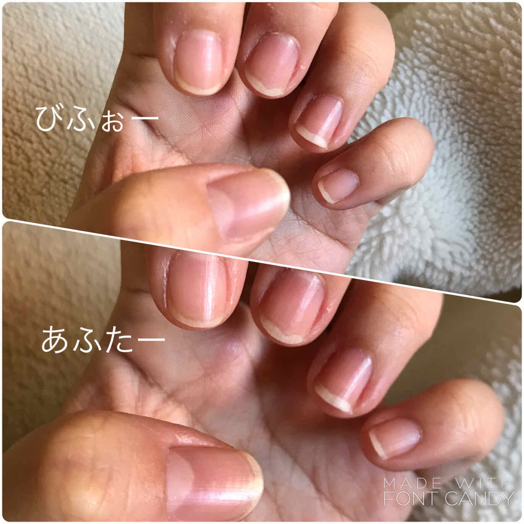 キューティクルリムーブペン アンドネイルの口コミ Nailキューティクルリムーブペン何を隠 By ぱーむ 混合肌 30代前半 Lips