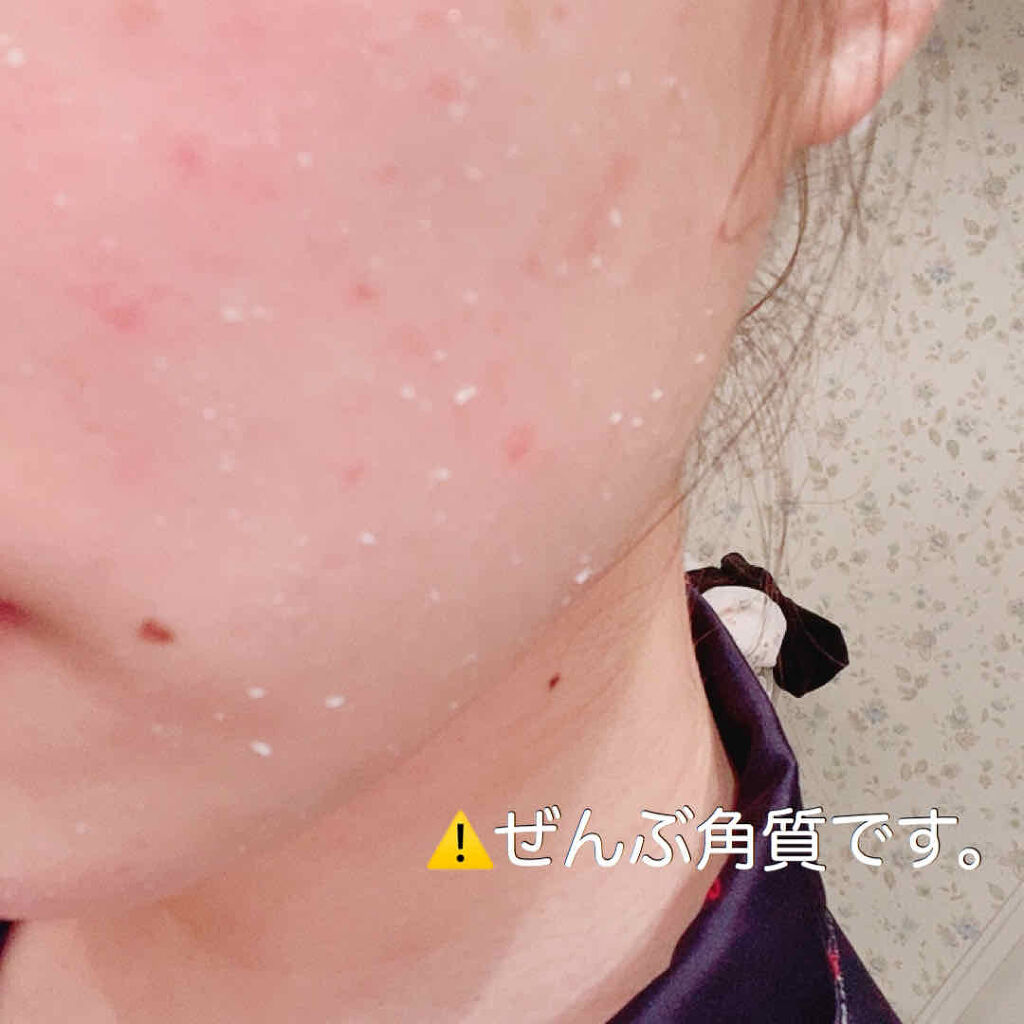 スペシャルパウダーソープcure Cureの口コミ 次の日の化粧ノリが確実よくなるピーリングケ By 乾燥肌 代前半 Lips