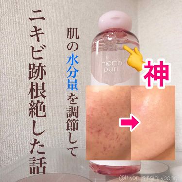 年代 肌質別 潤い化粧水 ももぷりの口コミ 1327件 Lips