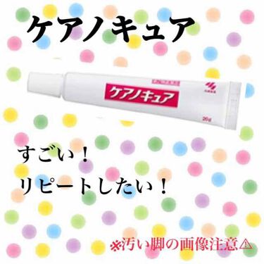 ケアノキュア 医薬品 小林製薬のリアルな口コミ レビュー Lips