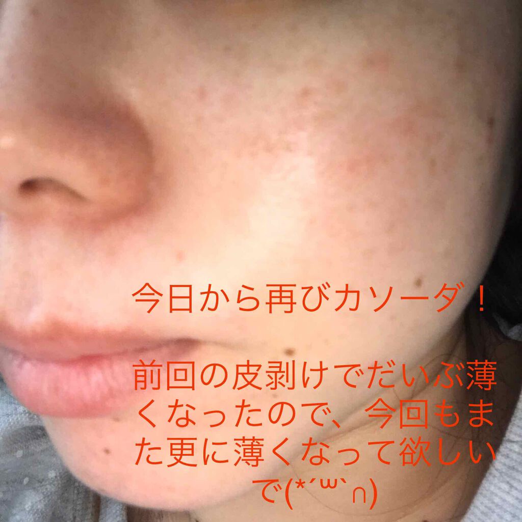 加香ひまし油 医薬品 日本薬局方の口コミ こちらの記事は自身の体験談掲載をしていま By しい 乾燥肌 Lips