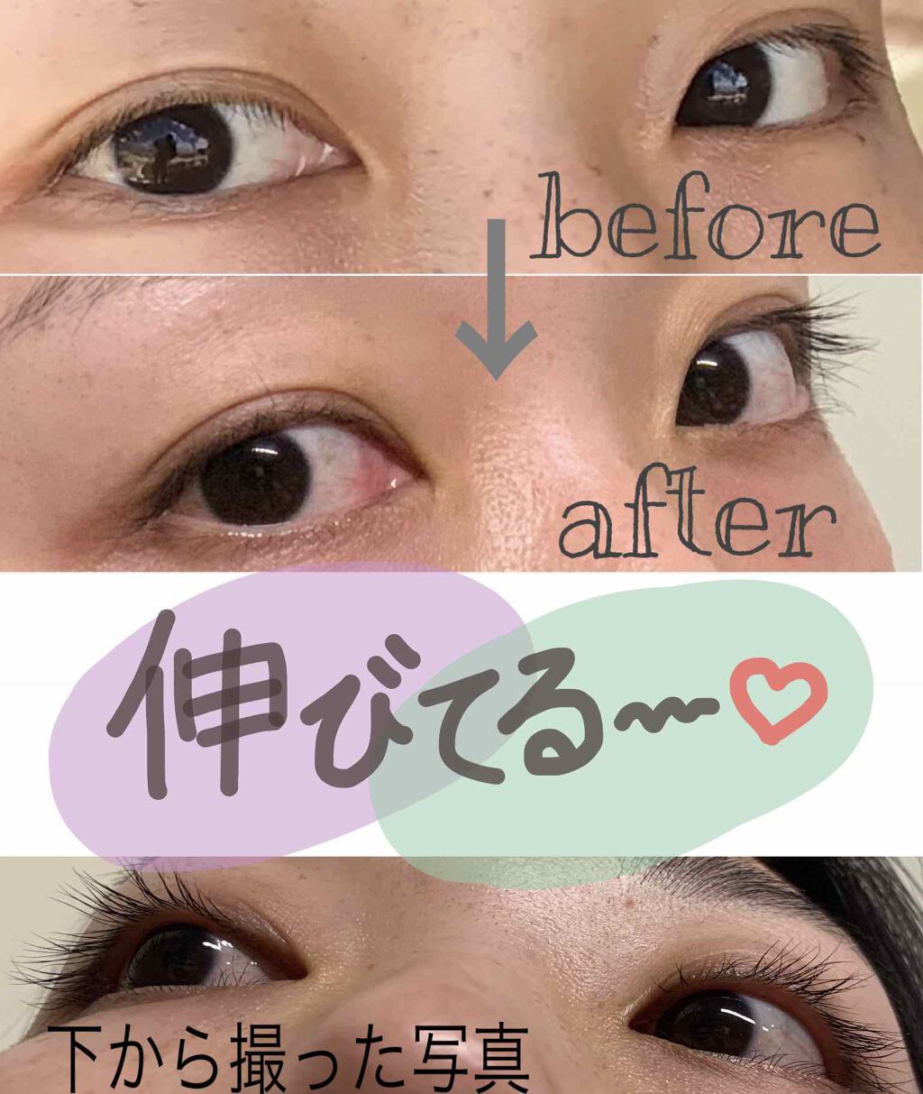 Emaked エマーキット 水橋保寿堂製薬の効果に関する口コミ あの有名なまつげ美容液 エマーキットのレビ By くるみさん 乾燥肌 代後半 Lips